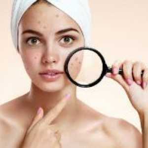 Ali je možno, da obrišite obraz z klorheksidina?