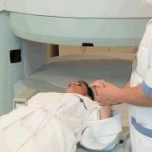 MRI vratne hrbtenice