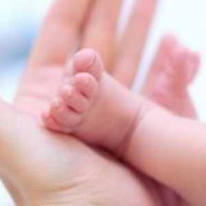 Non-imunski fetalnih hidrops
