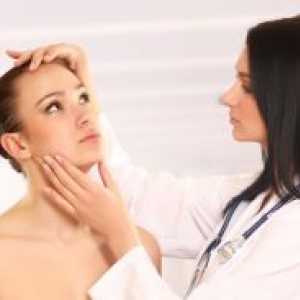 Nevritis obraznega živca - zdravljenje