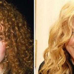 Nicole Kidman - pred in po plastičnih mas