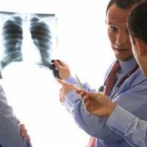 Obstruktivni bronhitis - Zdravljenje