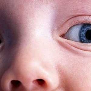 Otečene oči na otroka - kaj storiti?