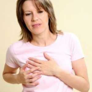 Akutni miokardni infarkt