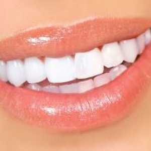 Beljenje trak za zobe