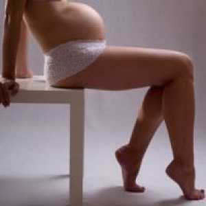 Otekanje med nosečnostjo