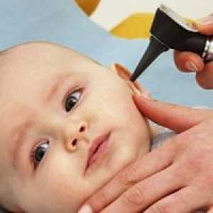 Vnetje srednjega ušesa pri otrocih - simptomi