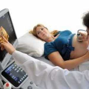 Prvi ultrazvok v nosečnosti - koliko tednov?
