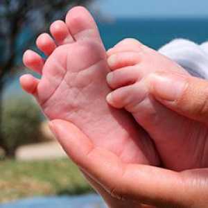 Ploska stopala pri otrocih