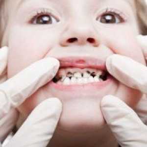 Zakaj otroci obrnejo črne otroške zobe?