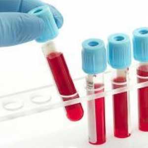 Zmanjšana hemoglobin - Simptomi