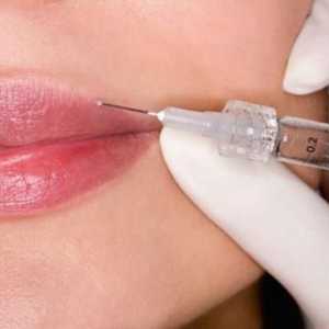 Princip delovanja in učinkovitosti Botox ustnic