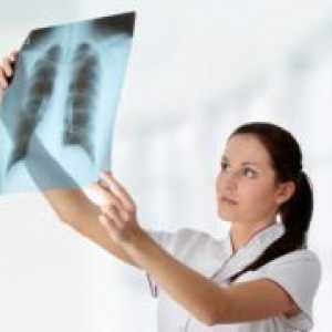 Preprečevanje tuberkuloze
