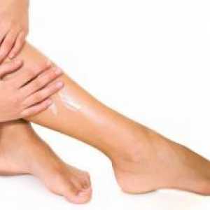 Preprečevanje krčne žile na nogah