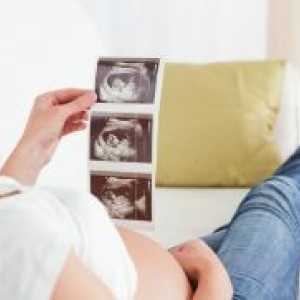 Proginova med nosečnostjo