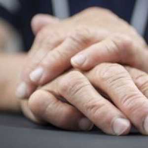 Psoriatični artritis - Simptomi