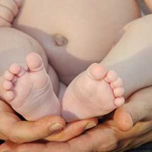 Popkovna kila pri novorojenčkih