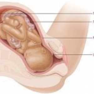 Razkritje materničnega vratu