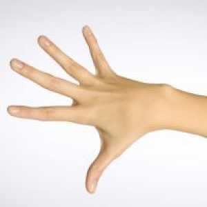 Raztezanje mišic roke - Zdravljenje