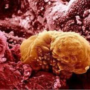 Razvoj zarodka na dnevih