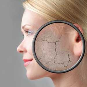 Močno luskasta koža na obrazu: Vzroki in zdravljenje