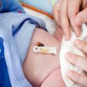 Kako se zdravilne popka za novorojenčka?