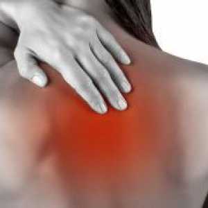 Spondiloze na prsni hrbtenici