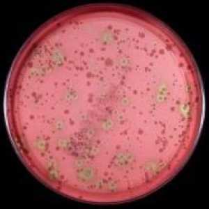 Streptococcus viridans