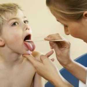 Streptokokni okužbe pri otrocih