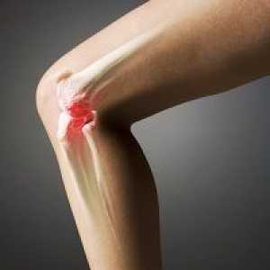 Artritičnih vaje za koleno