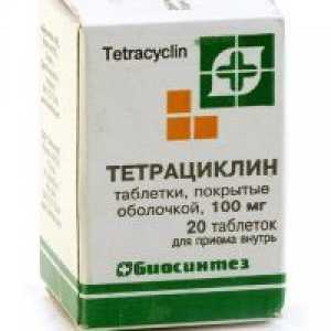 Tetraciklin za akne