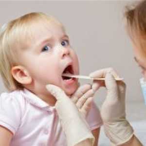 Traheitis pri otrocih - Zdravljenje