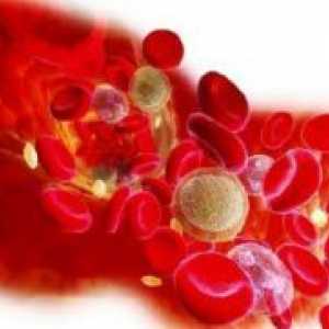 Trombocitopenija - Vzroki in zdravljenje