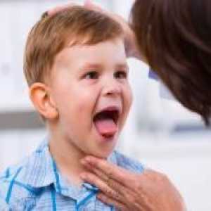 Otrok rumena jezik