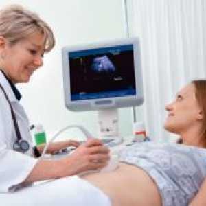 Ultrazvok maternice in priveski