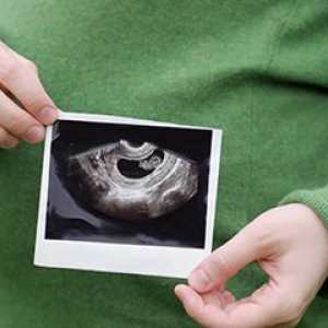 Uzi med nosečnostjo: časovnica