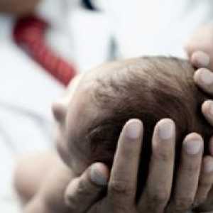 ICP pri dojenčkih - Simptomi