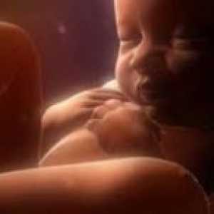 Maternični okužbe pri novorojenčkih