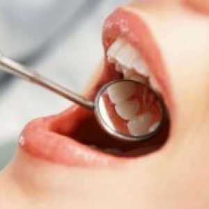 Bolezni dlesni - Zdravljenje