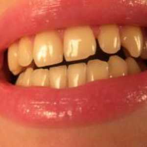 Rumene zobe